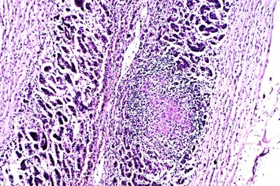 Figure 15