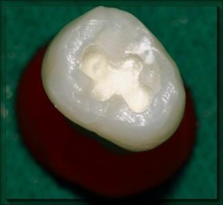 Figure 2: 90 samples of maxillary first premolars.