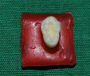 Figure 5: Samples showing dye penetration.