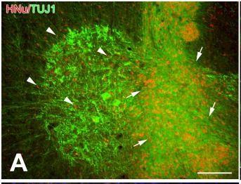 Figure 2: This study conducted by Xu, et al. [16] shows the progression of the grafted NSCs in the mice. This picture demonstrates, the live grafted NSCs migrating to the cervical cord (colored red). The white arrows represent the sites of inoculation.