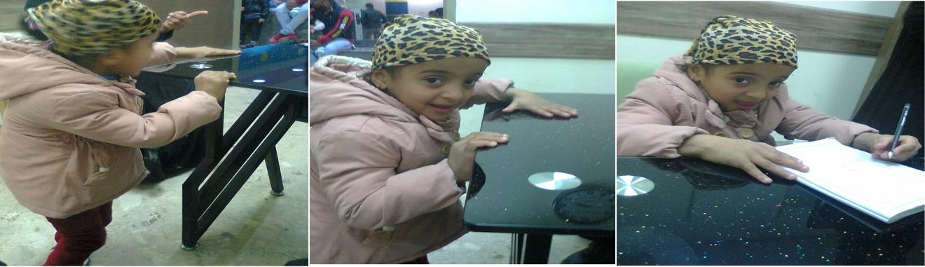 Figure 4: Patient-3, after treatment was able to stand and walk holding furniture. She showed improved fine motor skills and was able to hold a pen to try to copy a circle, and she could copy a circle.