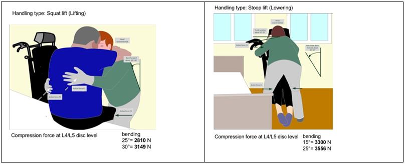 Figure 2: Moving a patient from bed to wheelchair. Compression forces calculated on 3DSSPP at L4 / L5.