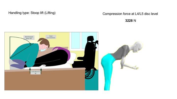 Figure 6: The patient in serious need of care is slowly transferred from the wheelchair to the bed. This creates extreme forward inclinations of the caregiver. With the knees, the patient is fixed (F2), the back is guided by F1, and next to it creates a surface pressure through the arm of the patient (F3).