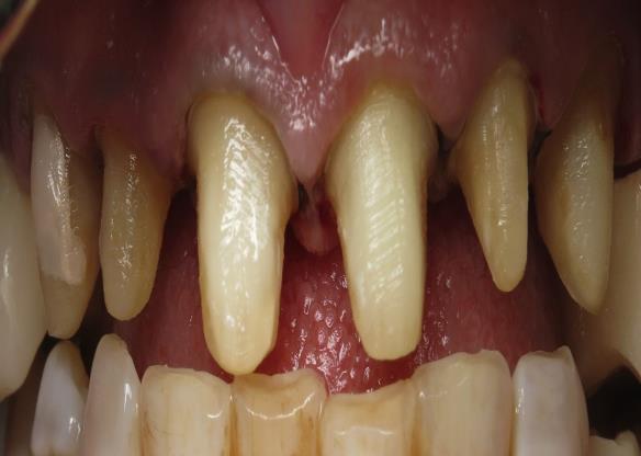 Figure 7: Final preparations occlusal view.