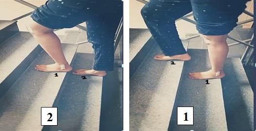 Figure 4: Knee joint position during stair climbing (Step over step pattern). Tester: If safety is concerned the tester should guard behind\below the participants going up the stairs. If there is no concern for safety, then the tester should remain on the start\finish position on the ground landing. The difference was considered statistically significant at a p value of <0.05.