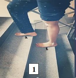 Figure 5: Knee ROM (1070).