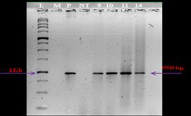 Figure 2: Amplification of hpt gene in the transgenic plants positive for Chitinase-11 gene.