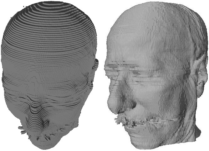 Figure 1: Dimensional model of human head: a) Voxel Model b) Model, reconstruct by Marching Cubes algorithm method.