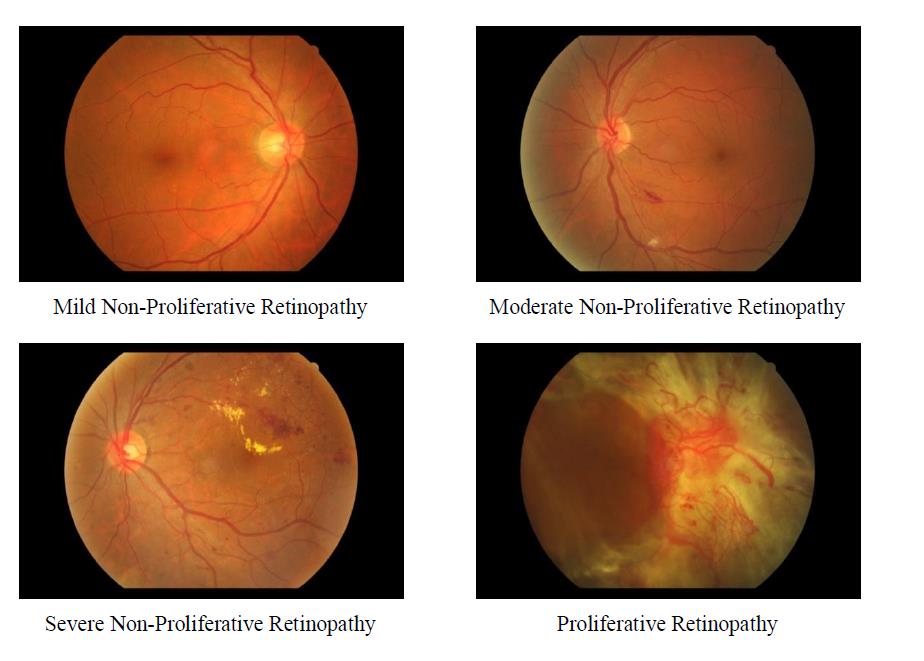 Figure 3: Gray-level transformed image. Spencer, et al.