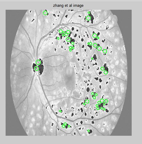 Figure 6: Zhang, et al. Lazar, et al.