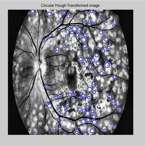 Figure 7: Lazar, et al. Sensitivity = [TP/(TP+FN)]*100 → (1) Specificity = [TN/(TN+FP)]*100 → (2) Accuracy = [(TP+TN)/(TN+FP+FN+TN)]*100 → (3)