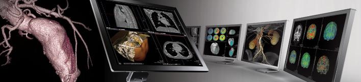 Figure 2: Vitrea 3D post processing workstation for cardiac CT angio.