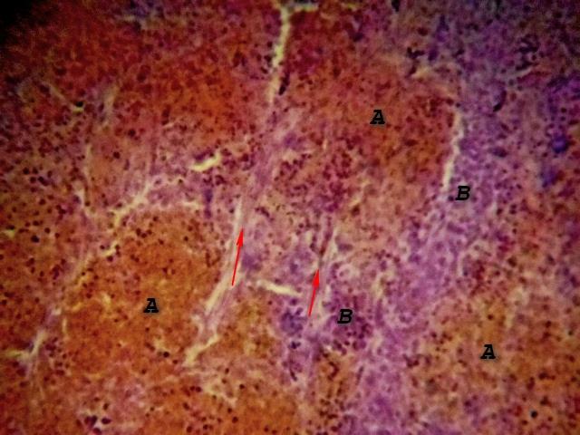 Figure 2: Photomicrograph of Camel Spleen showing clearly differentiated zones of white pulp (A) and Red pulp (B) cells with inter parenchymal traberculae collagen connective tissue fibers (Red arrow) H&E x200.