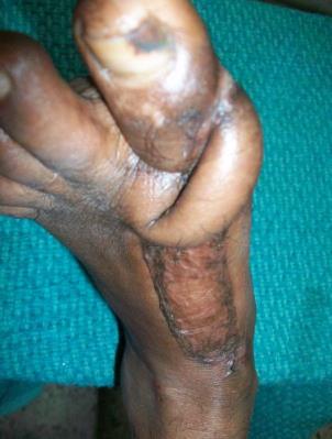 Figure 5: Follow up picture after 3 months.