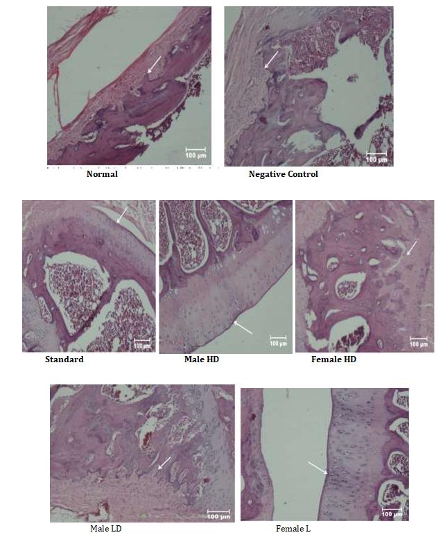 Figure 7: The histopathological Evaluation of CFA induced joint damage in the entire Group.