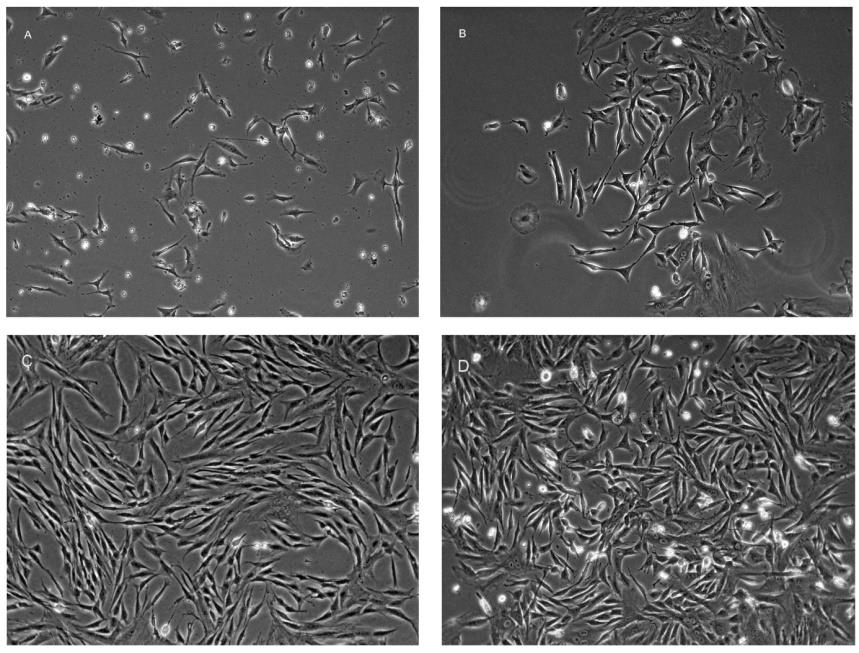 Figure 1: (A): Isolation of rbDPSCs. Fibroblast-like morphology-adherent cells, (B): the first passage cells, which proliferate in the form of CFU-F, (C): the second passage cells, (D) third passage cells. Microscope magnification is 10x.