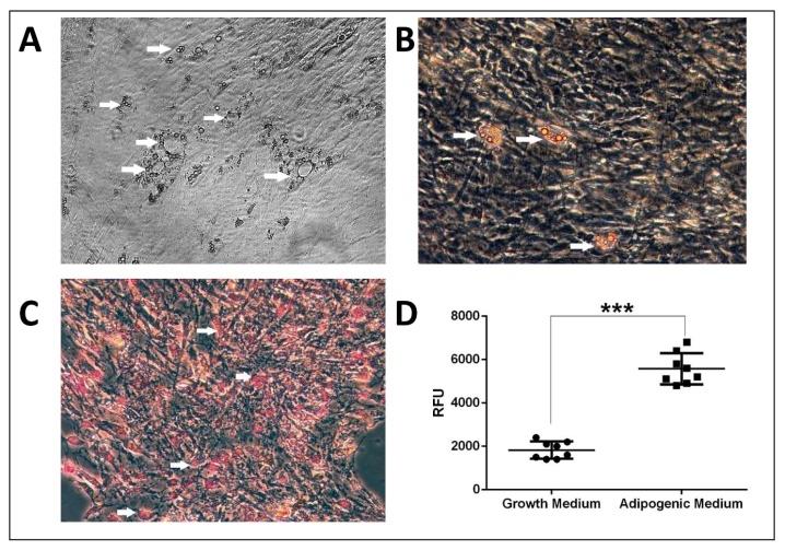 Figure 6: (A): Lipid droplets covering the entire cytoplasm at the end of day 21 are shown with white arrows, (B-C): triglycerides and fat droplets, which accumulate in the cells after AdipoRed staining, (D): AdipoRed fluorescence readings in growth medium and cells induced by adipogenic differentiation medium.