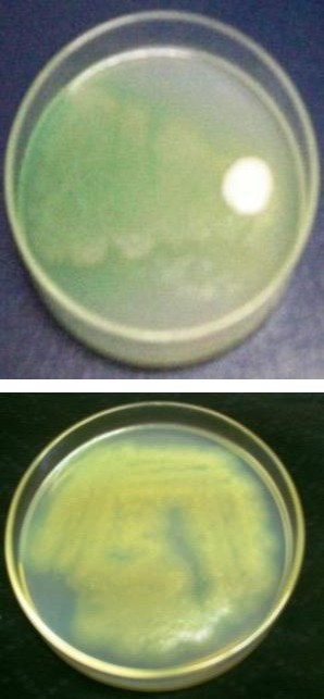 Figure 1: Catalase test. Selective media isolation: The isolated strain was grown on the _Pseudomonas_ isolation agar medium. This result confirmed that the isolated bacterium was _Pseudomonas_ _aeruginosa_ (Figure 2). In addition to that further characterization was done by biochemical analysis in Bose clinical laboratory, Simmakal, Madurai, Tamil Nadu, India. It strengthened the result as _Pseudomonas_ _aeruginosa_.