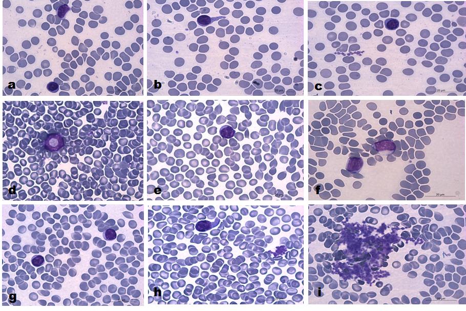 Figure 4: Images of blood smears as follows: upper line - healthy hamster treated with catholyte, middle line - tumor- bearing hamster (control) drinking tap water, and bottom line -tumor- bearing hamster treated with catholyte. May Gruenwald Giemza staining. Objective X 100.