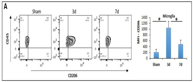 Figure 1: Figure 1: Structural domain organization of IRF4. DBD: DNA binding domain, LKD: linker domain, CIAD: C- terminal interferon activation domain, AR: Auto- inhibitory region.