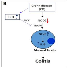 Figure 4: Role of IRF4 in inflammatory disease on immune cells. IRF4 affects development and differentiation of T-cells subtypes such as Th2 and Th17. IRF4 differentially regulates the pro- and anti-inflammatory cytokine levels in IBD via NOD2/ STAT3/RORγt signaling in naïve T-cells, and mediates the differentiation of Th2 and Th17 cells via GLi1/NFATc1/NFATc2 and STAT3/RORγt/Blim1/ICOS pathway respectively in autoimmune diseases in a lineage specific manner. IRF4 promotes differentiation of T-reg cells via Foxp3/Blimp1/ICOS signaling in obesity induced inflammation. In CNS, IRF4-SRF and Jmjd3-IRF4 regulatory axis regulate the neuronal degeneration and microglial activation respectively in ischemic stroke and AD. IBD; Inflammatory bowel diseases, RA; Rheumatoid arthritis, CD; Crohn disease, EAE; Experimental Autoimmune Encephalomyelitis, SLE; systemic lupus Erythematosus (SLE), MS; Multiple sclerosis, AD; Alzheimer’s disease.