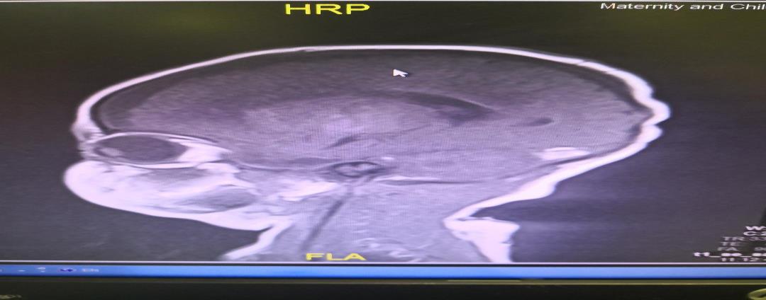 Figure 2: Imaging studies.