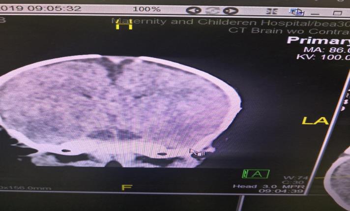 Figure 3: Differential Diagnosis.