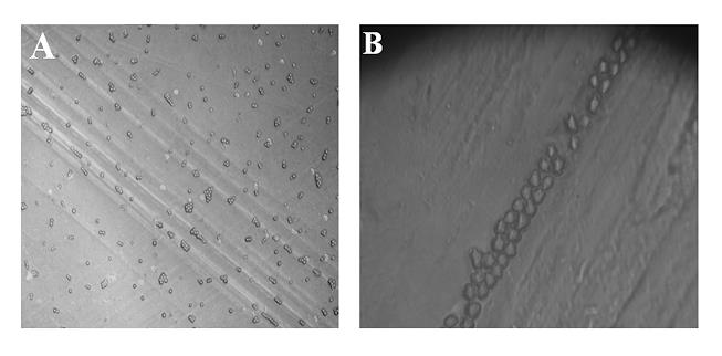 Figure 1: Positive culture of the Acanthamoeba spp. as visualized by inverted microscopy (A) with 10X objective (B) with 40X objective.