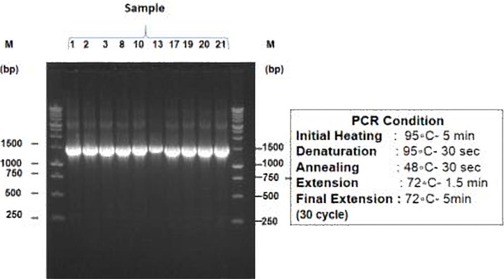 Figure 4: 16S rRNA gene profiles of 27F and 1492R primers generated from 10 different bacterial samples viz. - 1, 2. 3, 8, 10, 13, 17, 19, 2 and 21. ‘M’ refers 1kb DNA ladder (marker).