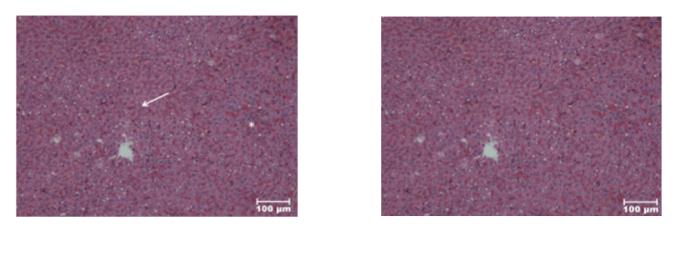 Figure 7: H&E, X100.