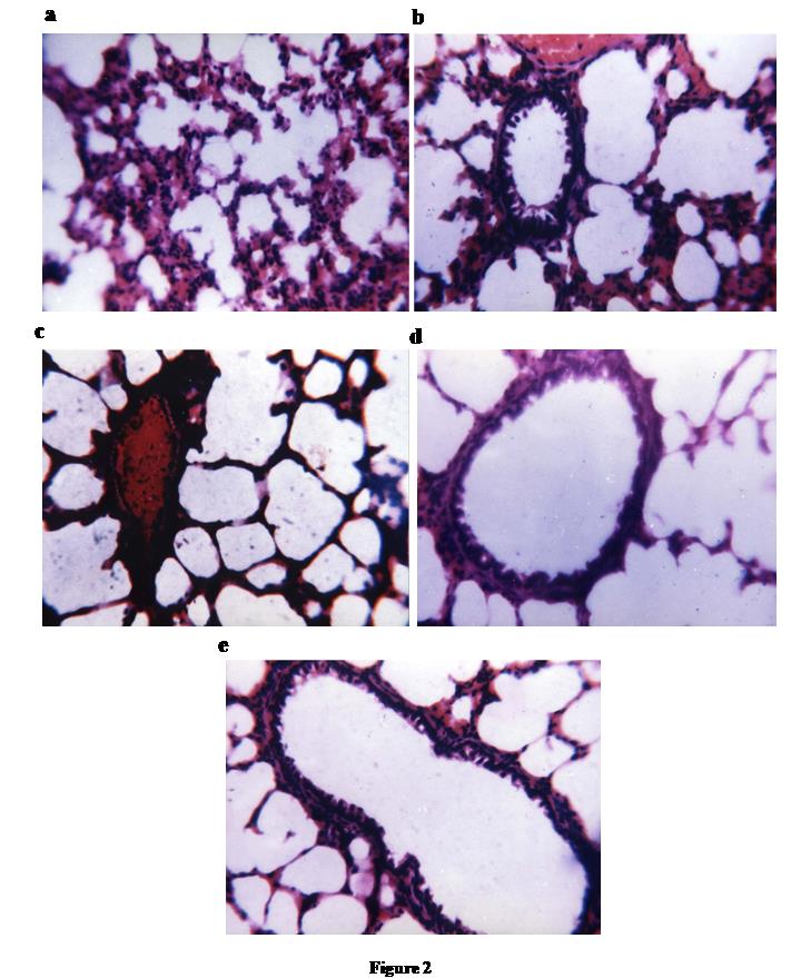 Figure 3: Testis, Histopathological analysis of testis sections of wistar rats after intraperitonial administration of B[a]P: a. Histopathological sections of Testis of control groups of Wistar rats (n=6), after intraperitonial instillation of DMSO (<0.1%) only, showing normal histological structure of active mature functioning seminiferous tubules associated with complete spermatogenic series. Magnification 100X, Scale bar=100µm. b. Histopathological sections of testis of adult Wistar rats (n=6), after intraperitonial administration of B[a]P (25 with increase lumen diameter in higher doses of B[a]P exposure after intraperitonial administration of B[a]P (50 mg/animal) at PND28. It also showed marked degeneration of most of the somniferous tubules with absence of spermatogenic series in tubular lumen and congestion in testis blood vessels after 15 days. Magnifications 100X, Scale bar =100µm.