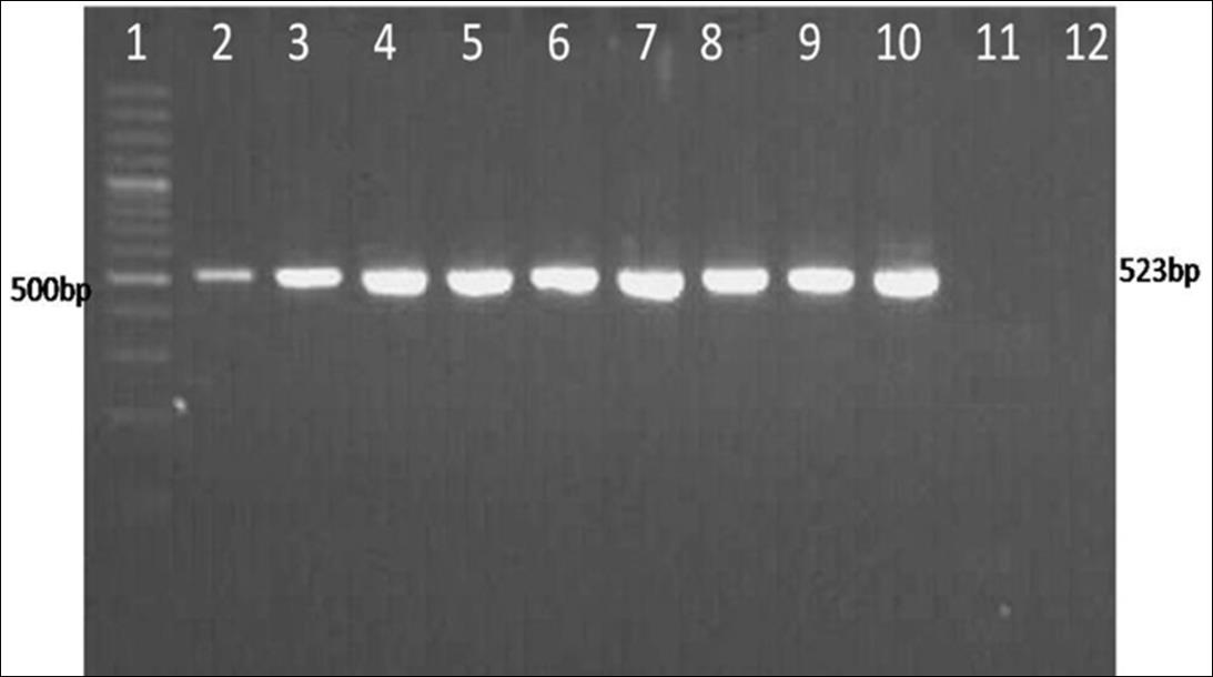 Figure 1: Amplification of M Gene For Detection of Coronavirus in Buffalo Fecal Samples Using Self Designed Primers (MF/MR). Lanes 1: 100 Bp Ladder, 2-10: Positive Field Samples, 11: Negative Field Sample, 12: Negative Control Nuclease Free Water.
