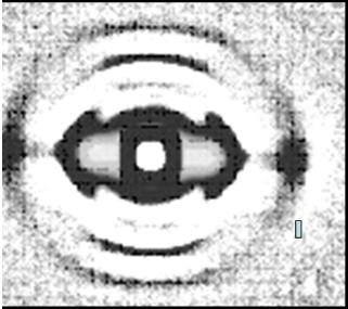 Figure 3: All subsequent helical tails will be so marked as the hair grows, until the cancer is removed.