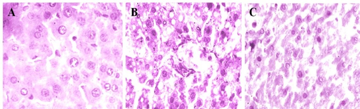 Figure 3: Liver histopathology of control and experimental rats. A) Control; B) AFB1; and C) AFB1 + G. gynandra Extract treated.