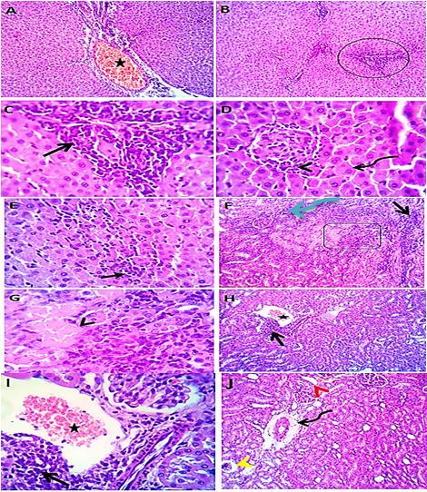 Figure 4: Photomicrograph of liver (A & B) showing apparently normal hepatic parenchyma with preserved cords arrangement, central veins, sinusoids, portal triads structures. Kidney (C & D) showing normal glomerular and renal tubular structures. H & E X 100 (A ,C), 400 ( B,D).