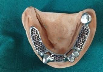 Figure 3: Final Impression.