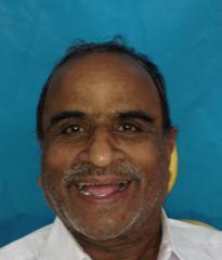Figure 9: Post -op Intraoral View - Telescopic Overdenture.