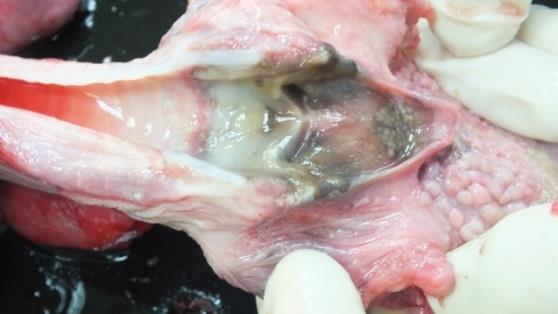 Figure 5: Corrosive necrotic changes of the laryngeal mucosa.
