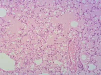 Figure 9: Edema of the lungs (HEx40).