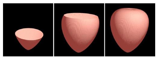 Figure 6: Heart sequential vertical sections (POV-Ray 3.7 rendering). View Animation (requires internet connection)