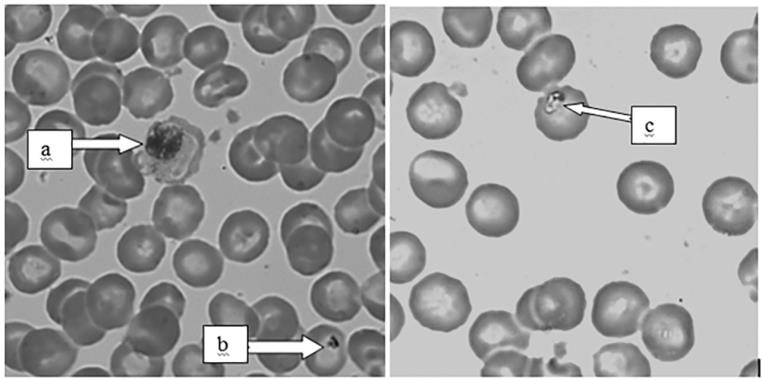 Figure 1: Giemsa stained blood smear with erythrocyte infected with a) Hepatocystis kochi b) Babesia and c) Entopolypoides (X 100).