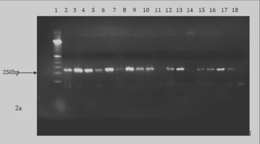 Figure 2: a) Representative gel showing the polymerase chain reaction product for Hepatocystis. Kochi (250bp) lane 2-18 with lane 7,11 and 14 being negative. 2b) Babesia microti (505bp) lane one being 100bp ladder with only lane 17 being positive whiles the rest negative.