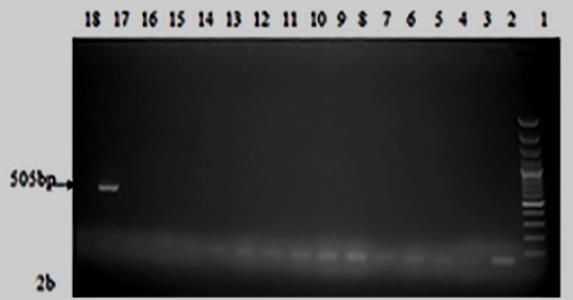 Figure 3: Prevalence of the parasites based of the Blood smear and PCR diagnosis.