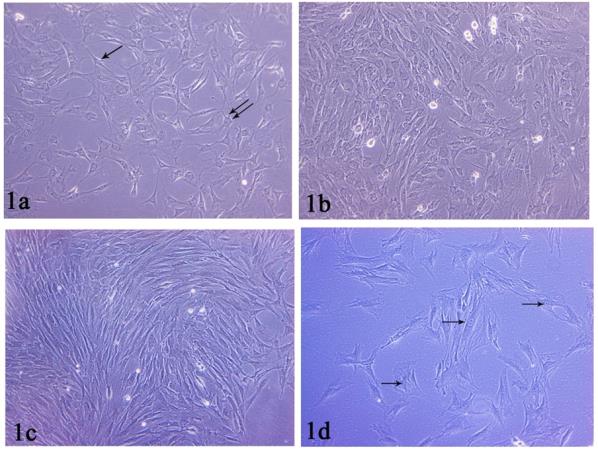 Figure 3: 3a: Photomicrograph of control group (I) showing numerous atrophied fat cells (↑). The atrophied cells contain peripheral acidophilic rim of cytoplasm and multiple fat vacuoles. Notice: intense cellular infiltrate. 3b: Photomicrograph of control group (I) showing few normal sized adipocytes, numerous small sized adipocytes (↑) and multiple large fat cysts (star). Notice: Severe inflammatory cellular infiltration, multiple blood vessels (arrow head). (H&E x100).