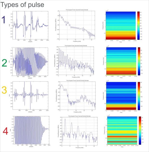 Figure 4: Distortion (thd Matlab function), dB and Hz of the fundamental frequency (F0), pulse length, number of peaks and peaks per ms.