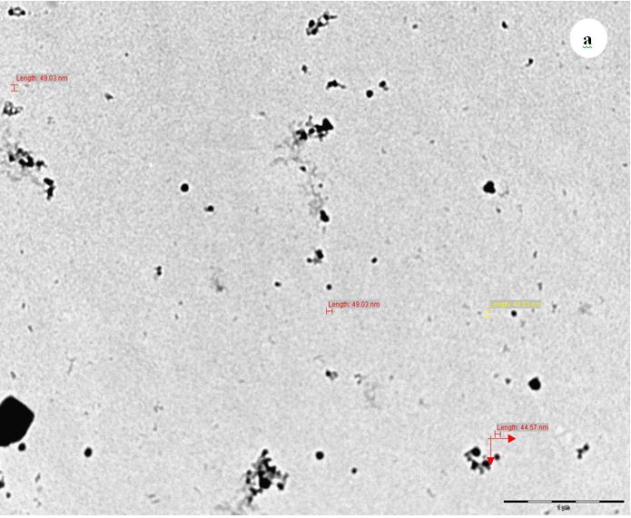 Figure 6: Transmission electron microscopic image and histogram showing synthesized AgNPs from Anisomeles indica