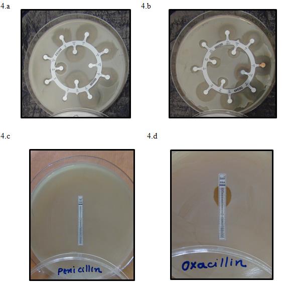 Figure 4: Antibiotic resistance of MRSA strains with Dodecca Staphylococci- 1 and 2 (4a and b) and Minimum Inhibitory Concentration using MIC strips (HiMedia, Mumbai) for penicillin (4c) and oxacillin (4d).