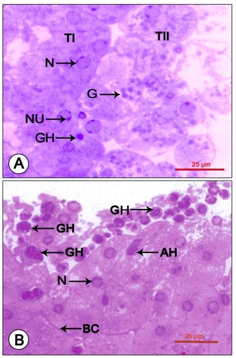 Figure 2: Photomicrograph showing mandibular organ during the reproductive phase (December). (A) Mandibular organ with compactly packed type I cells and loosely arranged type II cells enclosing prominent nuclei with nucleoli and cytoplasmic granulations. (B) Mandibular organ displaying copious granular and a few agranular hemocytes in large blood sinuses. AH: Agranular hemocyte; BC: Blood capillary; G: Cytoplasmic granule; GH: Granular hemocyte; N: Nucleus; NU: Nucleolus; TI: Type I cell; TII: Type II cell