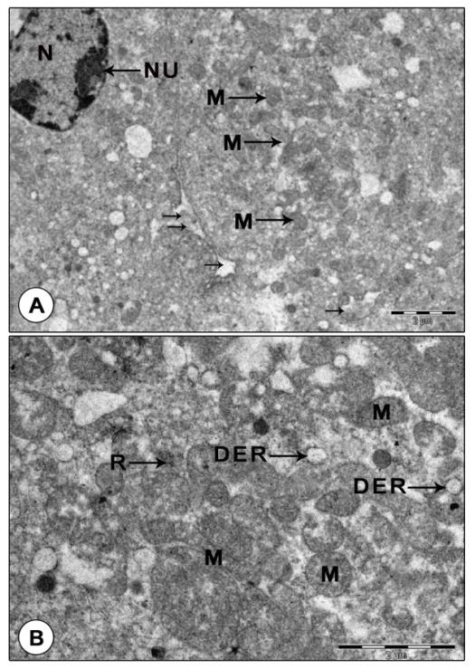 Figure 5: Transmission electron micrograph of mandibular organ cells during pre-reproductive phase (July). (A) Gland cells displaying nucleus with nucleoli, many small oval to elongate mitochondria and dilated RER vesicles. Note the blood sinuses between the gland cells. (B) A portion of the gland cell enlarged illustrating mitochondria with indistinct cristae. DER: Dilated RER cisternae; M: Mitochondria; N: Nucleus; NU: Nucleolus; R: Ribosomes; Arrows indicates the blood sinuses.