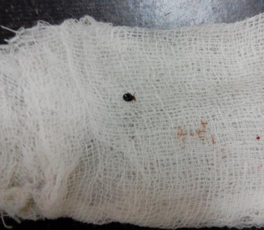 Figure 2: Tick after removal.